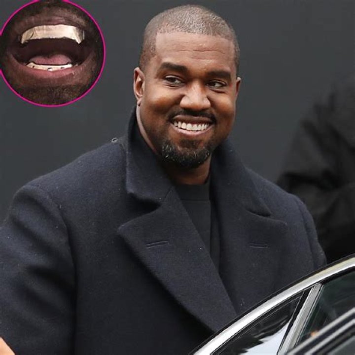 Kanye West gets 850K titanium dentures modeled after James Bond spy