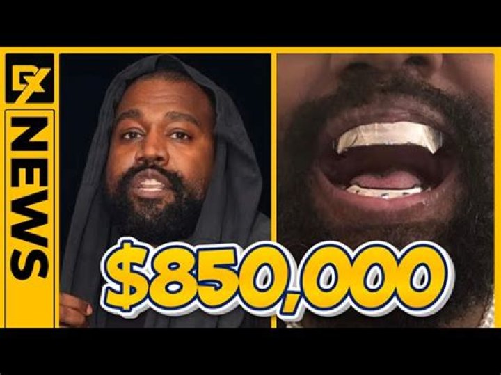 Kanye West shows off new Jawsinspired teeth after getting '&pound;670,000