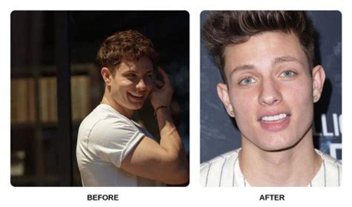 Matt Rife Before Fixing His Teeth The Wild &lsquo;n Out Star&rsquo;s Glow Up Examined!