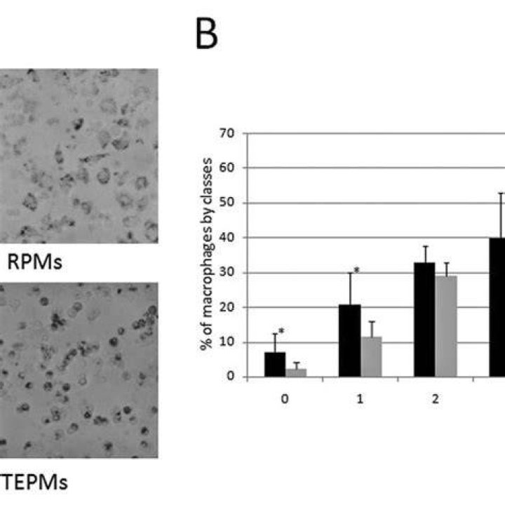 Microscopic NBT test for characterization of peritoneal macrophages