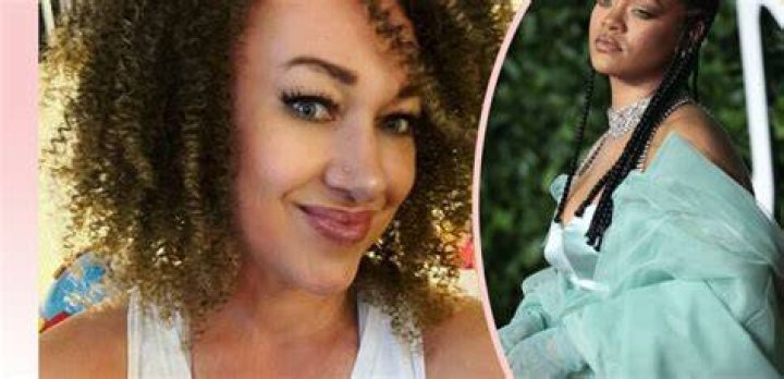 OMG, Rachel Dolezal Has An OnlyFans, The Pictures Leaked, & She Speaks