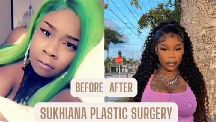 Sukihana Before Plastic Surgery Brazilian Butt Lift & Veneers?