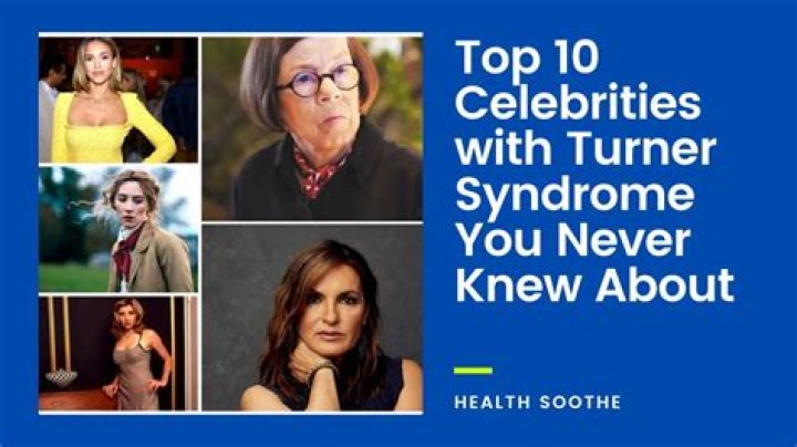 Top 10 Celebrities With Turner Syndrome You Could Never Think Of