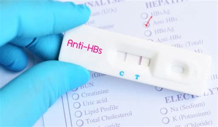 What is AntiHBS, what does positive and negative AntiHBS mean